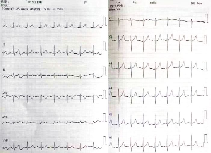 甯歌鐨勫績鍐呯鍏稿瀷鐥呬緥,蹇冨唴绉戠殑鍏稿瀷鐥呬緥