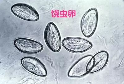 屁股里面痒是蛔虫还是蛲虫,宝宝屁屁疼是不是有虫