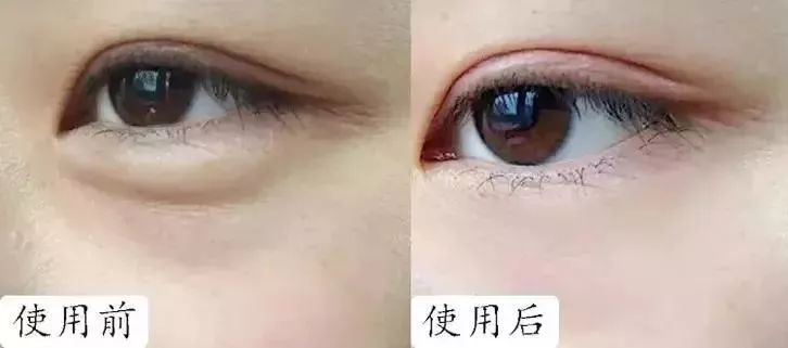 马应龙水晶眼膜视频,马应龙八宝多肽眼膜