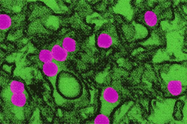 最新新冠病毒怎样消毒,行家介绍防范新冠病毒感染措施