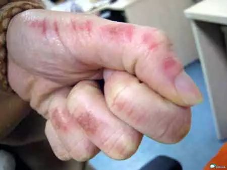 水产养殖纳米银在什么时候才能用,纳米银在水产上功能