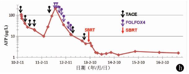 行家访谈肝癌,曾昭冲给谁治疗过