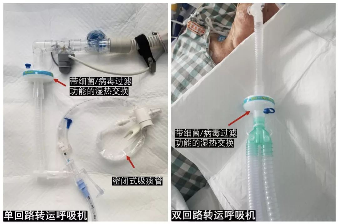 新型冠状病毒感染诊治指南,新型冠状病毒肺炎危重治疗原则