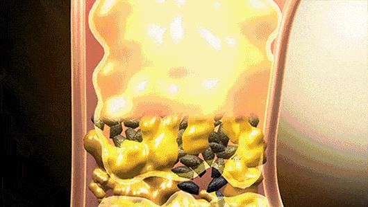 7天挑战无头屑,挑战5天不洗头依旧蓬松不油头