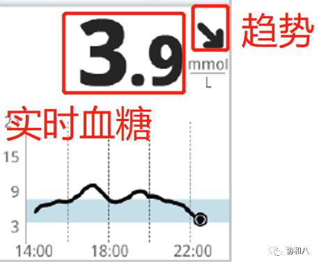 它是如何24h监测你的葡萄糖水平|一页手册·协和八