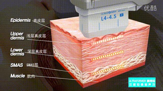 虞书欣澄清自己没有医美,虞书欣做什么医美