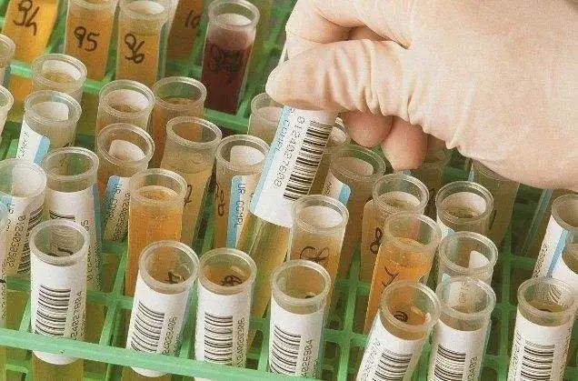 糖尿病为何要检测尿微量白蛋白,糖尿病与尿微量白蛋白有什么关系