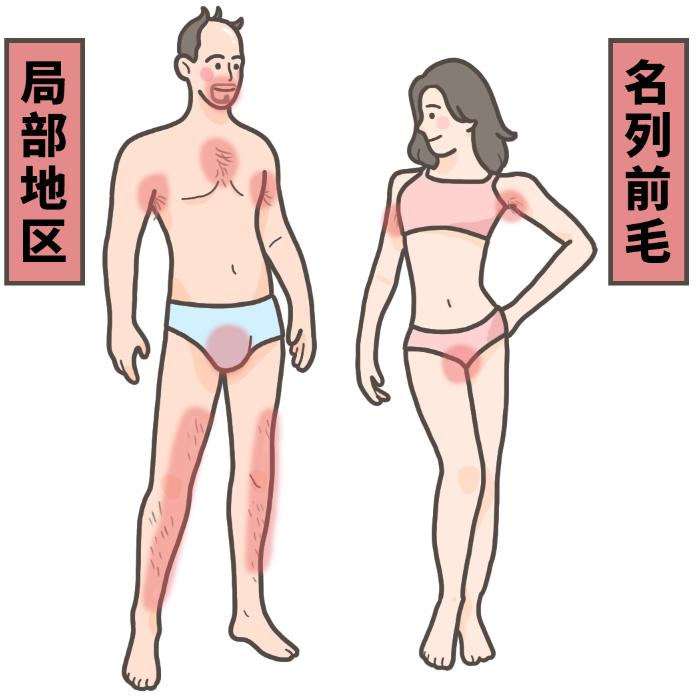 漫画科普冷知识,漫画夏天所反映了什么内容