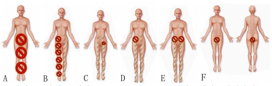分娩镇痛的适应症和禁忌症,分娩镇痛对产程的影响ppt