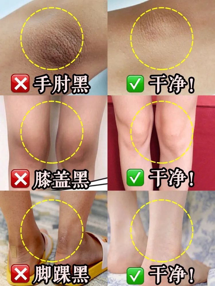 蜜诗肌酵素去角质凝胶,蜜诗肌酵素去角质