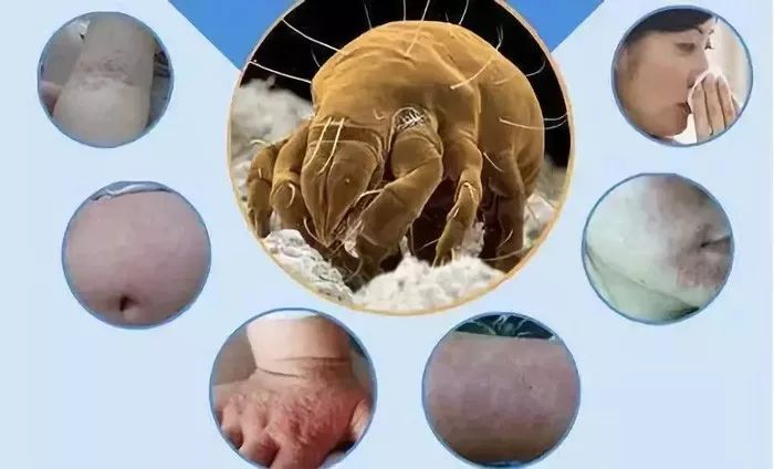 用什么洗脸抑制螨虫生长,用什么洗脸能够抑制螨虫生长