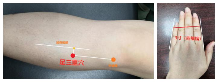治疗青春痘中医古方也能迅速奏效,奇效火针治疗青春痘