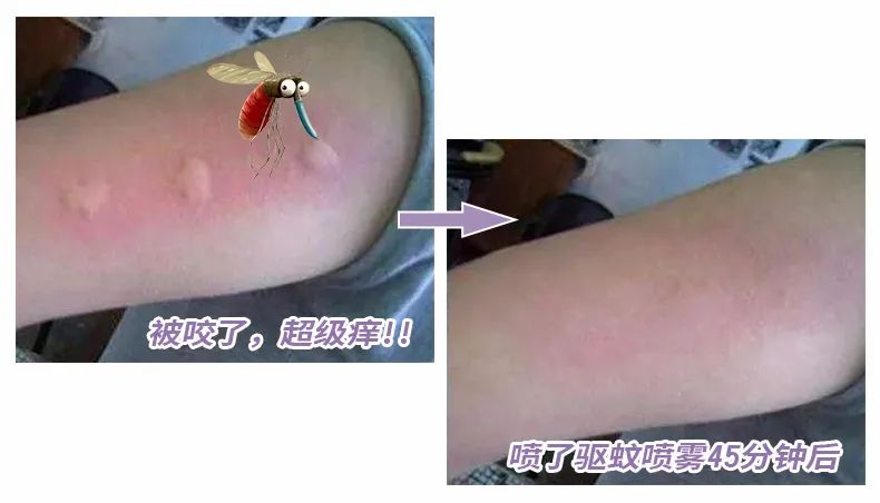 儿童驱蚊小神器,驱蚊神器防蚊又能止痒