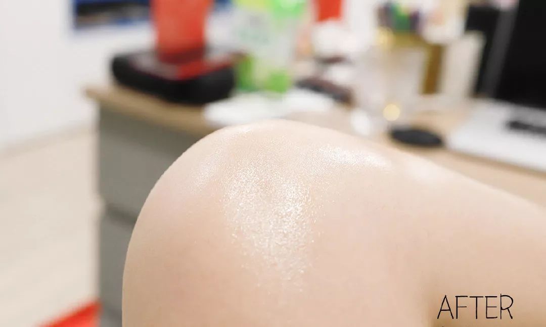 别放弃，烦人的“鸡皮疙瘩”，真的还能够再救一下