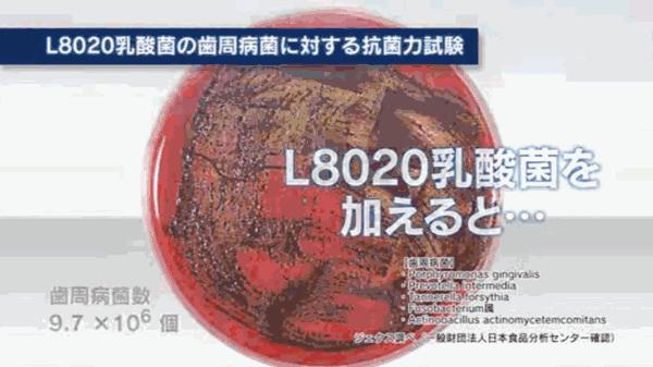 酸奶味漱口水,乳酸菌漱口水会导致蛀牙吗