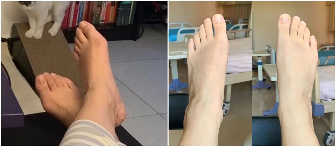 做完医美真的能换脸吗,做完医美需要注意什么