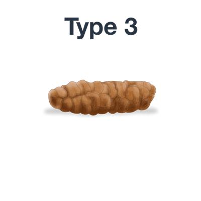 最近大便稀粘稠粘马桶,马桶粘大便有什么妙招