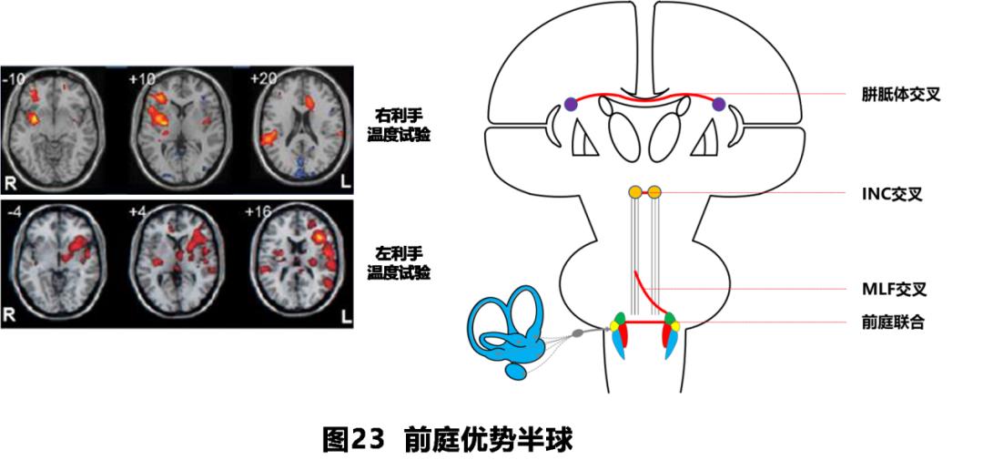 前庭性眩晕百科介绍,周围性眩晕和中枢性眩晕解剖基础
