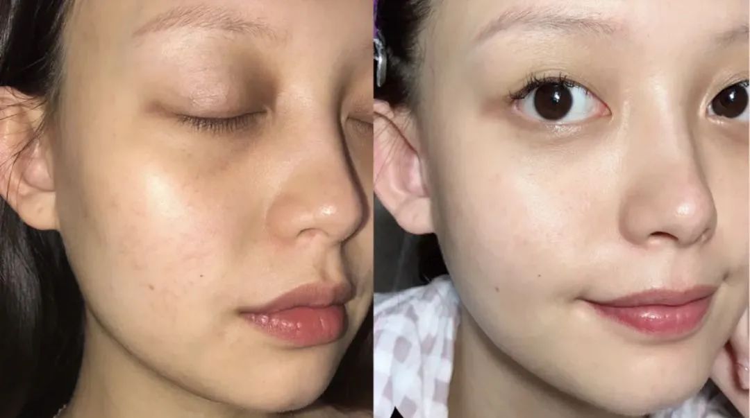 日本人用酒洗脸，60岁还没有皱纹，黑头粉刺全消失，整张脸白皙光滑，细腻弹润