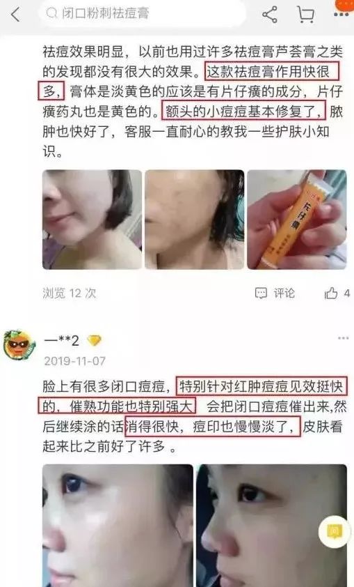 祛痘痘痘印最有效的国货产品,老国货治痘痘