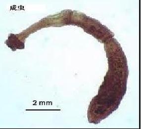 地方病防治宣传核心信息—碘缺乏病、包虫病、地方性氟中毒