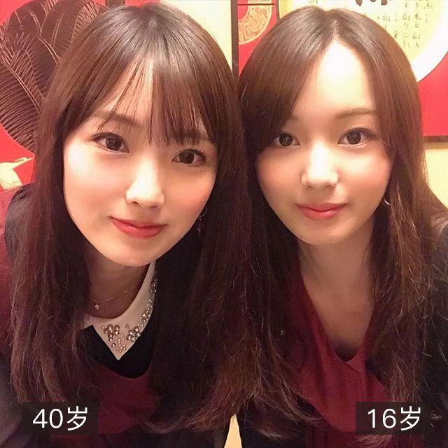 抬头纹眉间纹怎么去除,眉间纹抬头纹去除最好的方法