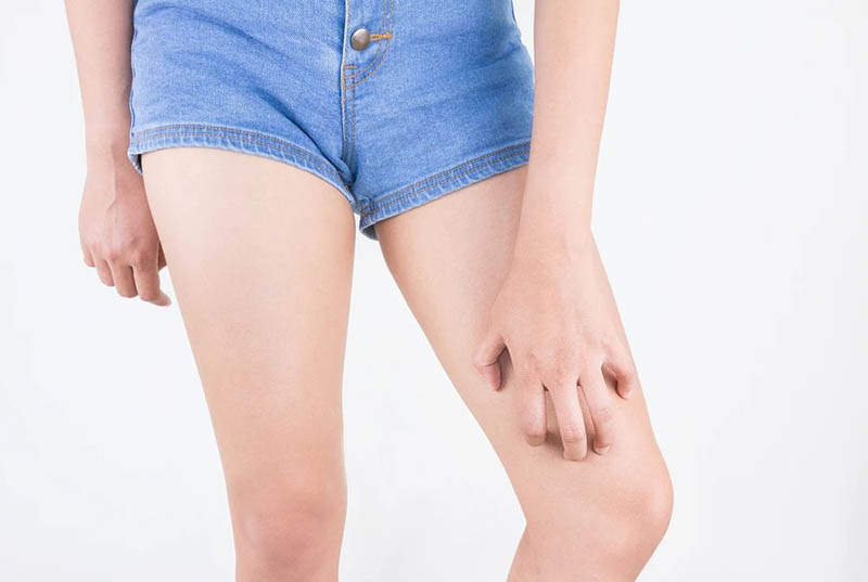 皮肤特别干燥缺水痒怎么办,夏天皮肤干燥缺水起皮怎么办