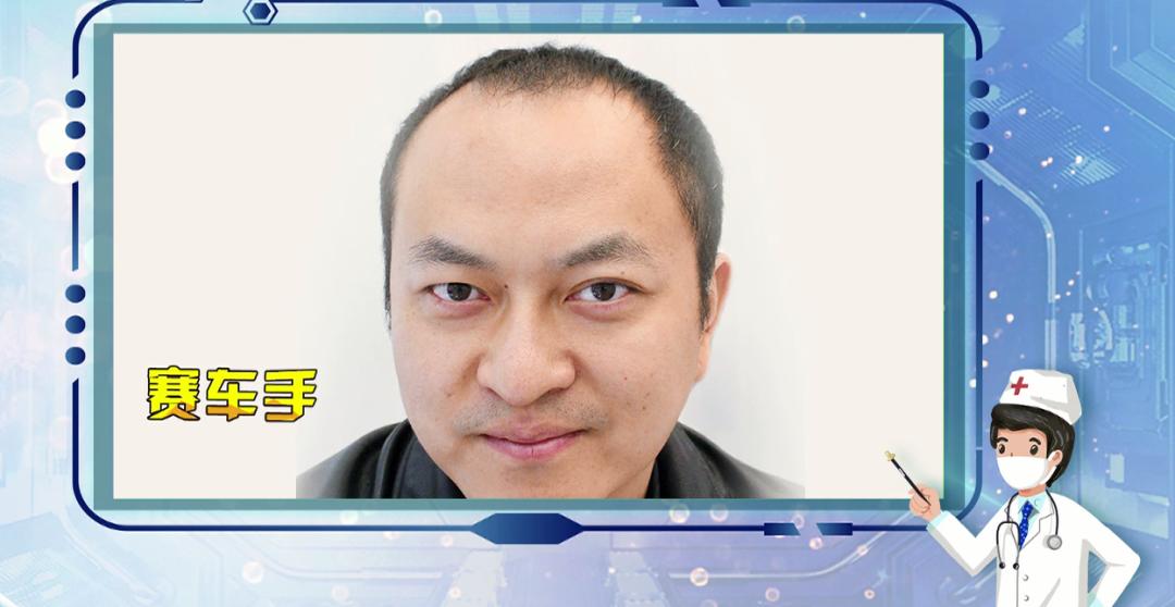 如何拯救“秃”如其来的尴尬？今晚19:30，收看海南卫视，为您揭晓答案