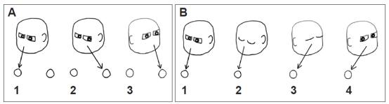前庭眩晕康复科普,前庭康复训练方法和步骤