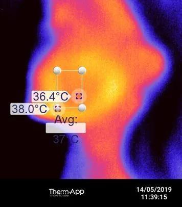 怎么科学有效延缓皱纹,9个原因让你的皱纹长得飞快