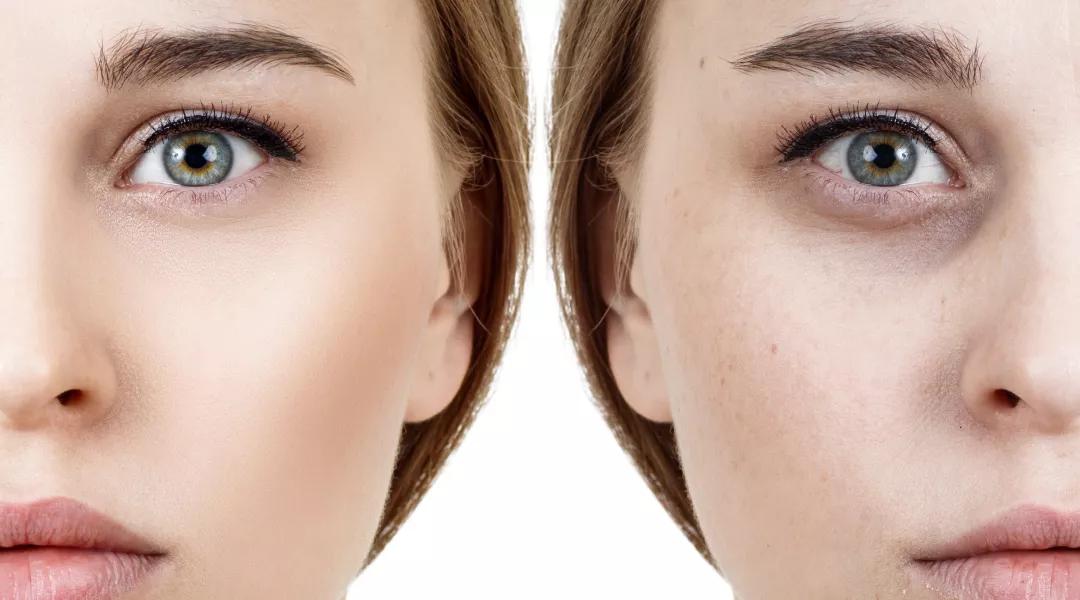 有眼纹和黑眼圈推荐使用的眼霜,合适有眼纹黑眼圈的眼霜