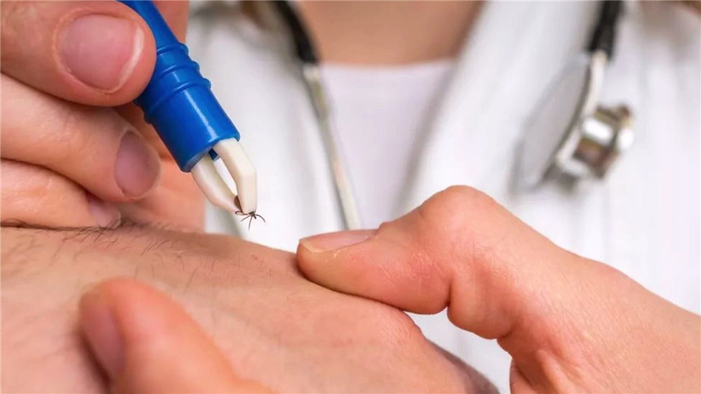 蜱虫疾病高发期省医院行家：被咬要尽快就医