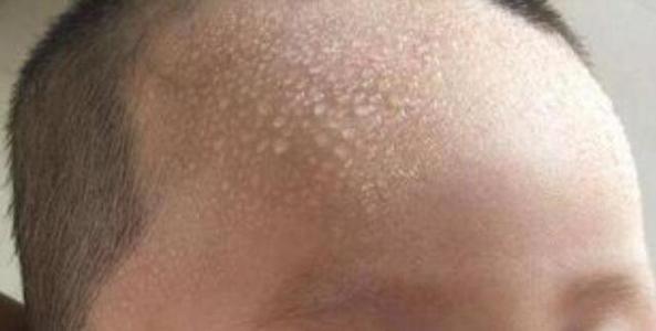 宝宝睡觉满头大汗是真的热吗,宝宝睡觉满头大汗是盗汗吗