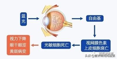 近视的孩子建议吃什么护眼,孩子近视应该吃什么护眼片比较好