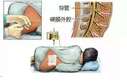 凭借“醉美手护圈”上海市同仁医院又获得一等奖