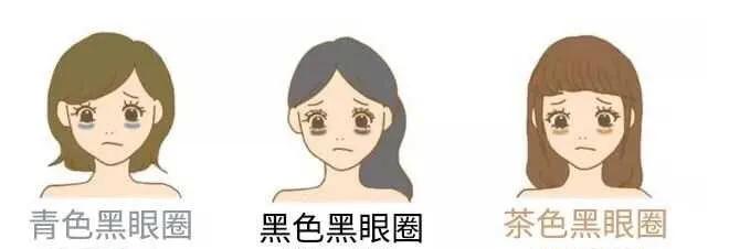 黑眼圈越来越重怎么搞定黑眼圈,简单有效缓解黑眼圈的两个小方法