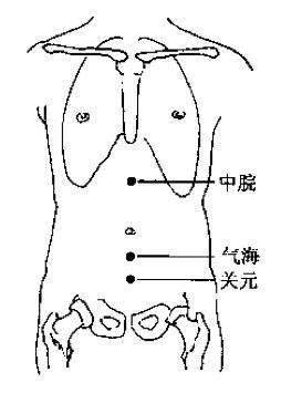 灸法医鉴pdf完全版下载,灸法医鉴