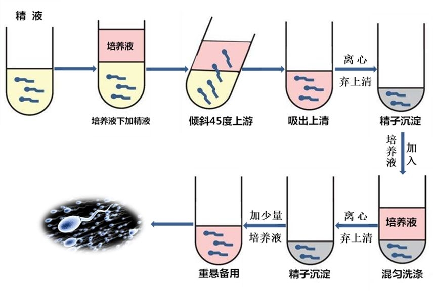 看呆医生：一次告捷！医院人工授精太贵，英女子购买针筒自行操作