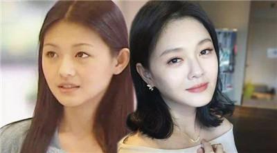 日本第一三美白丸成分,美白丸推荐款式