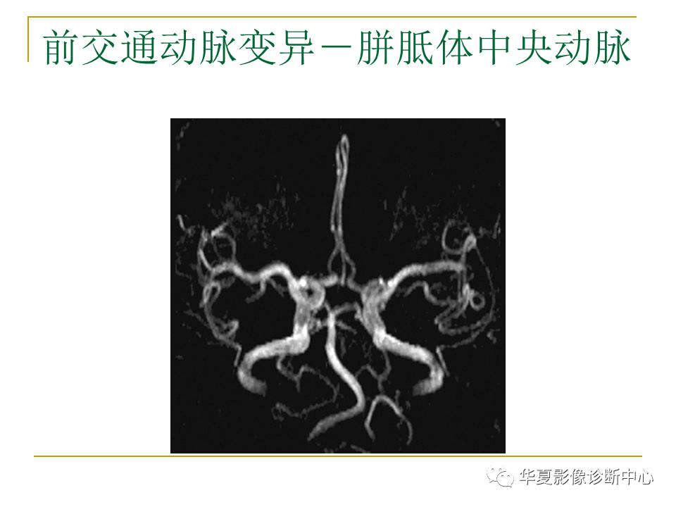 中国人脑立体定向mri应用解剖图谱,脑mri示意图