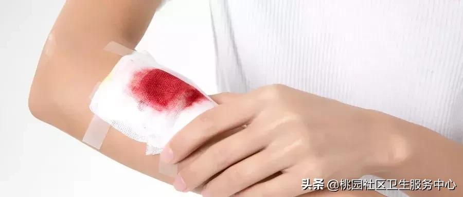 铁皮划伤手一直出血打破伤风针吗,孩子手被小刀划伤需要打破伤风吗