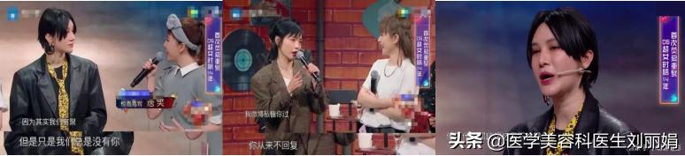 尚雯婕单眼皮吗,尚雯婕参加王牌视频