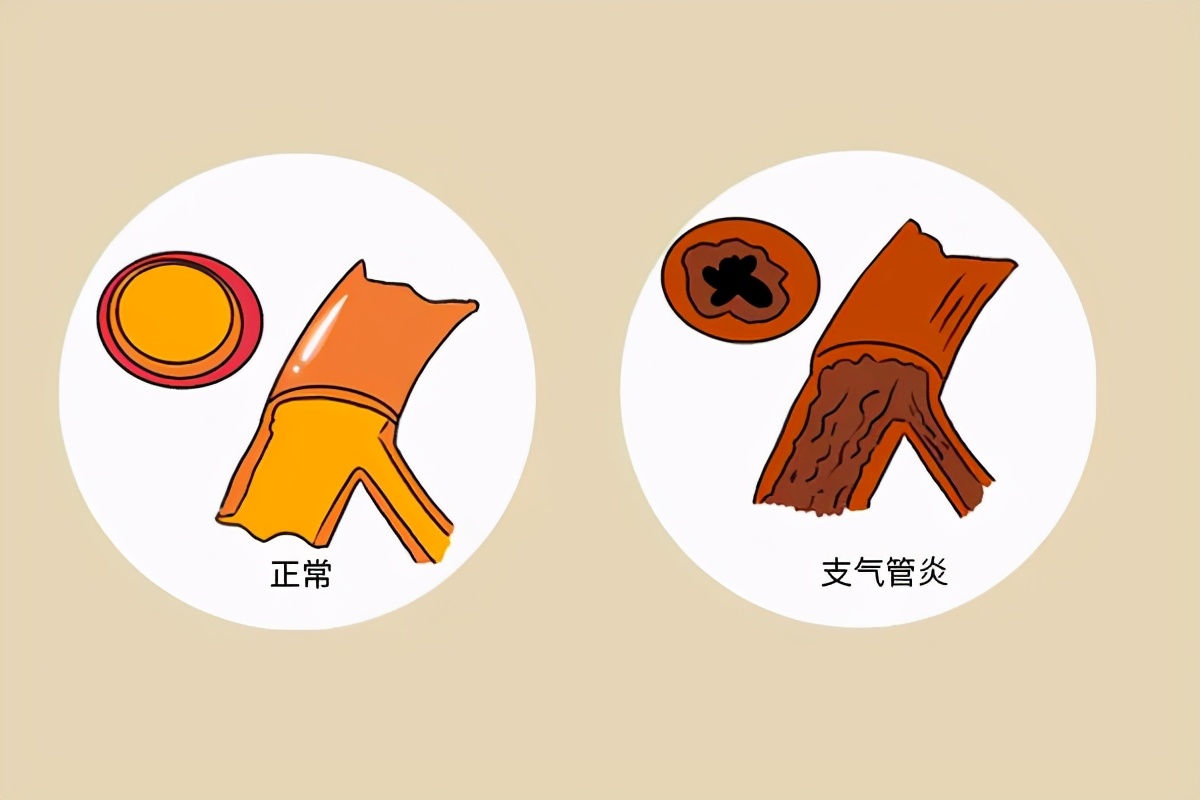 有什么办法帮烟戒掉,烟瘾太大怎么戒烟最有效
