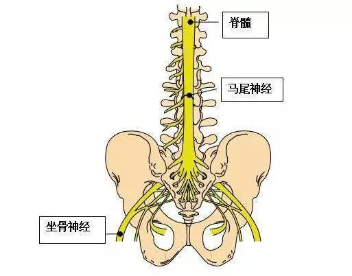 腰椎间盘突出压迫马尾能治好么,腰间盘突出压迫马尾神经怎么治愈