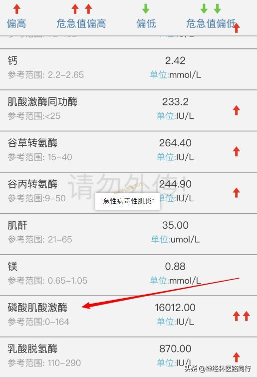 流感持续24小时高热怎么办,流感走路不稳