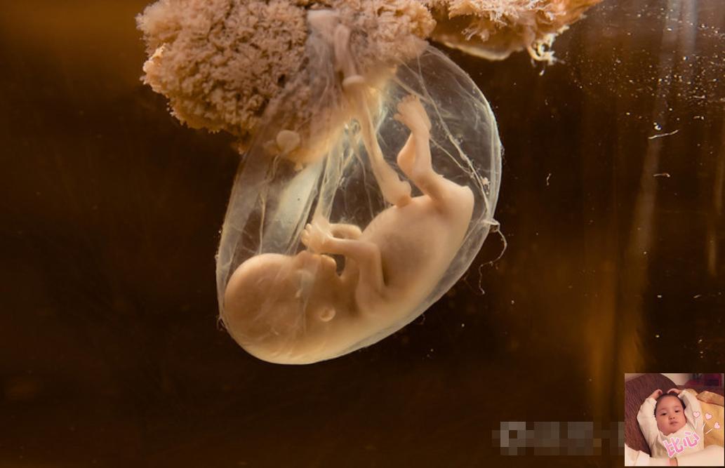 吃榴莲后胎儿胎动频繁好不好,孕妇吃榴莲胎动频繁正常吗