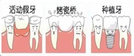 牙齿缺失多颗如何种牙,多颗牙齿缺失怎么种牙