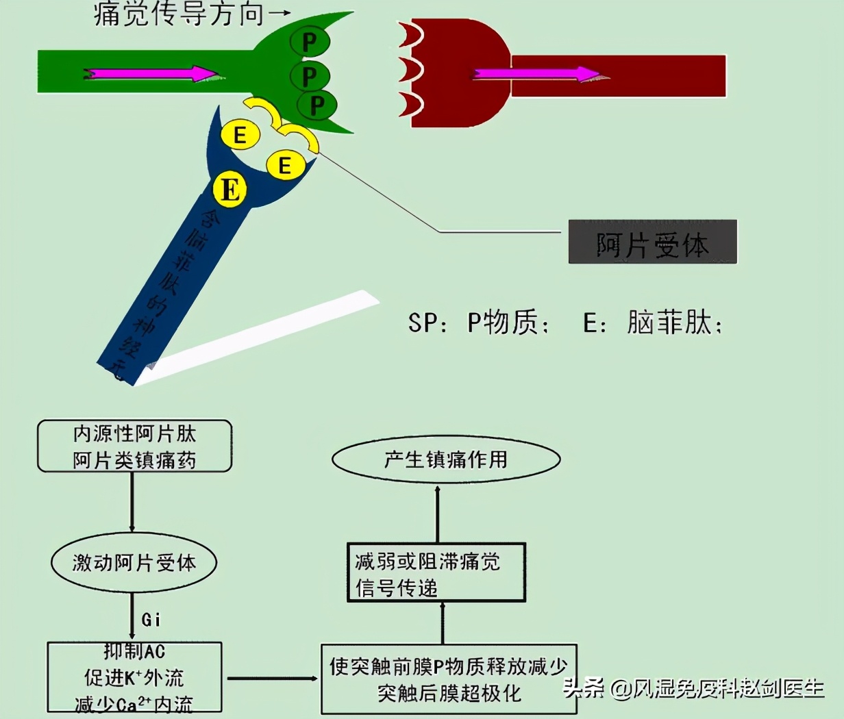 骨关节炎吃药能够做理疗吗,退化性骨关节炎需要终身服药吗
