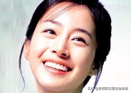 钢牙套矫正的全过程,牙齿稀疏矫正合适隐形还是钢牙套