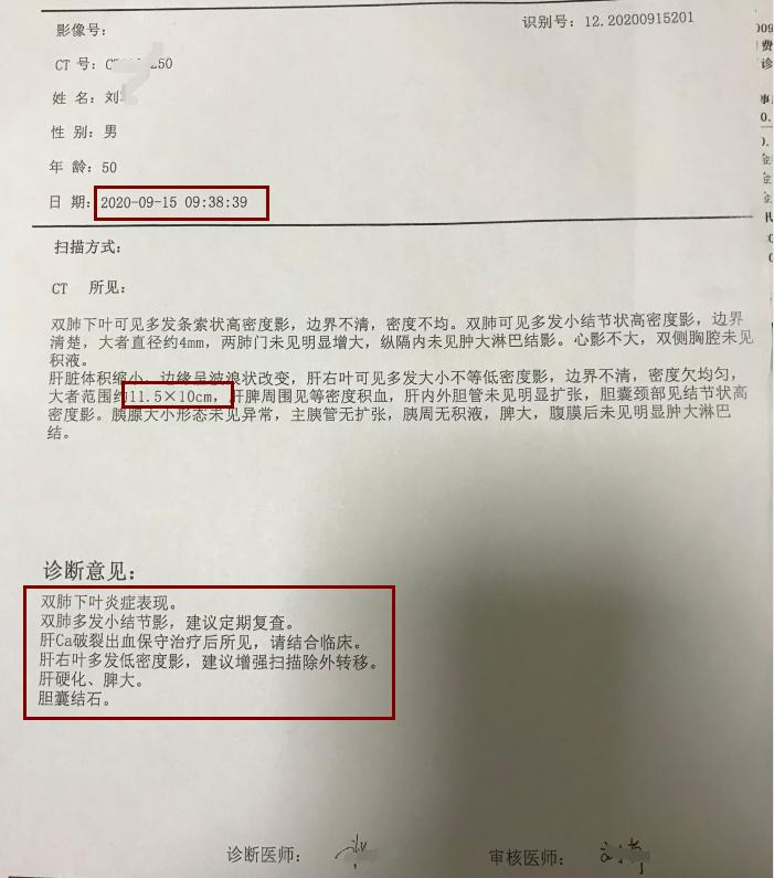 中西结合治疗肝癌效果如何,肝癌肿瘤破裂出血怎么治疗